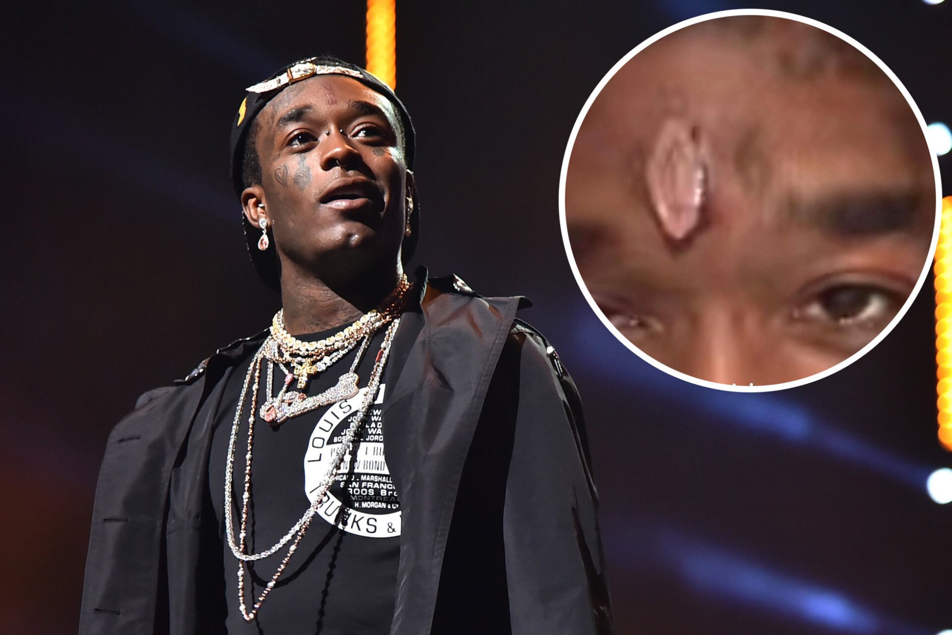 Lil Uzi Vert implanted 175 Crore worth diamond into his forehead